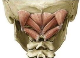 Deep muscles of the neck holding the Atlant in the wrong position